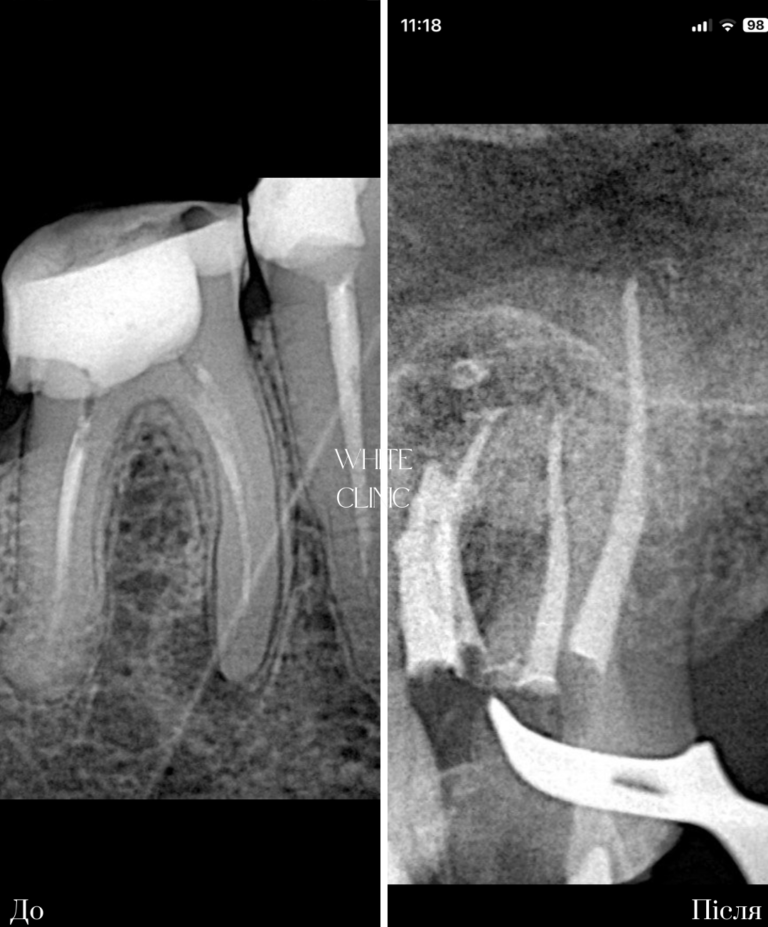 endodontia 2