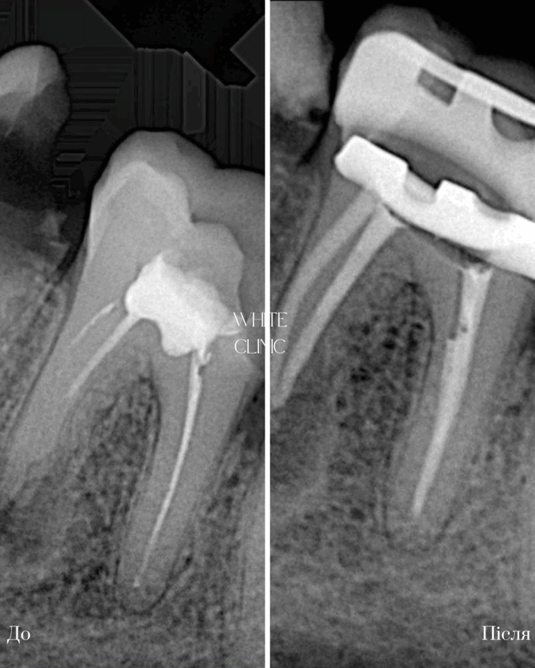 endodontia 5